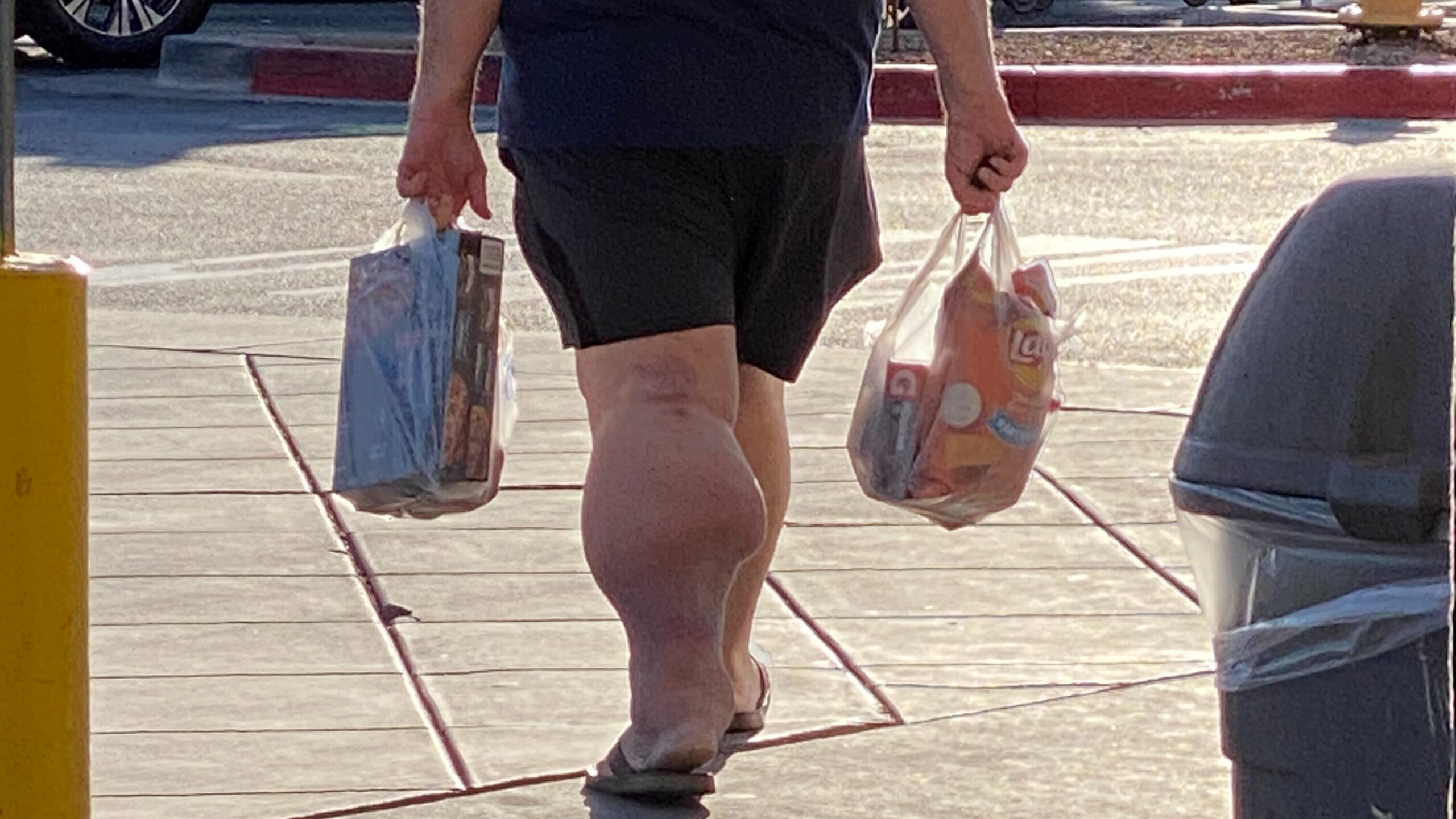Obese Man Walking With Groceries